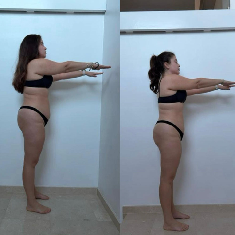 Transformation 5